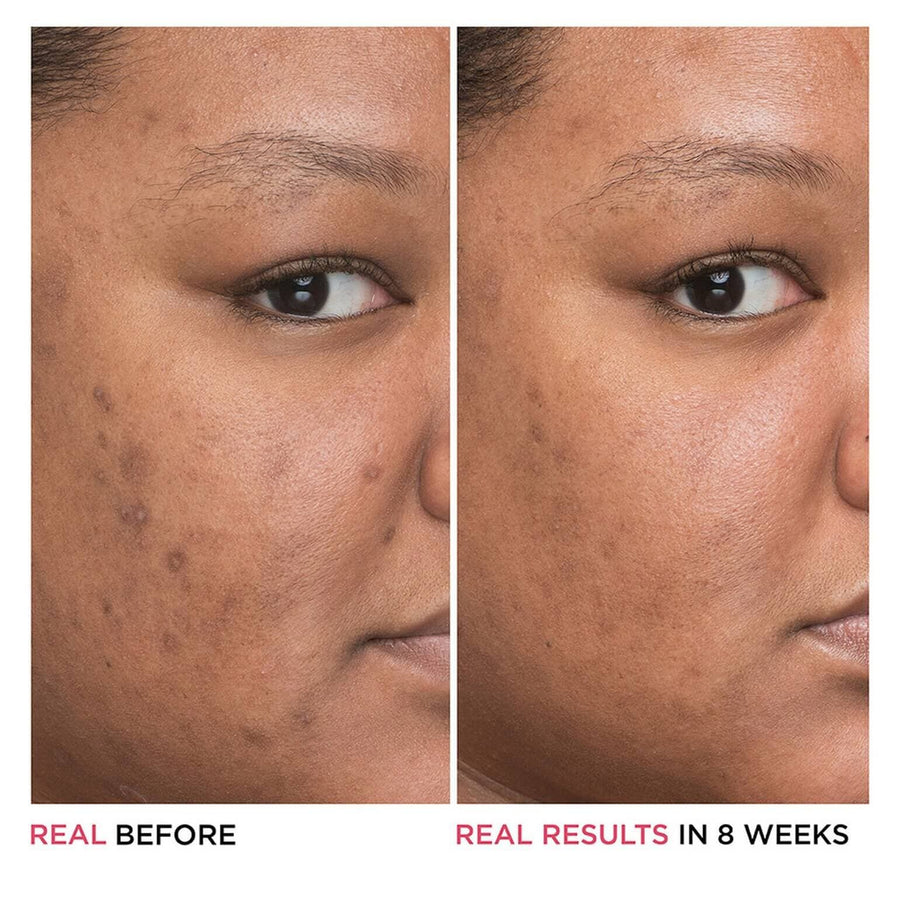 BYE BYE DARK SPOTS NIACINAMIDE SERUM