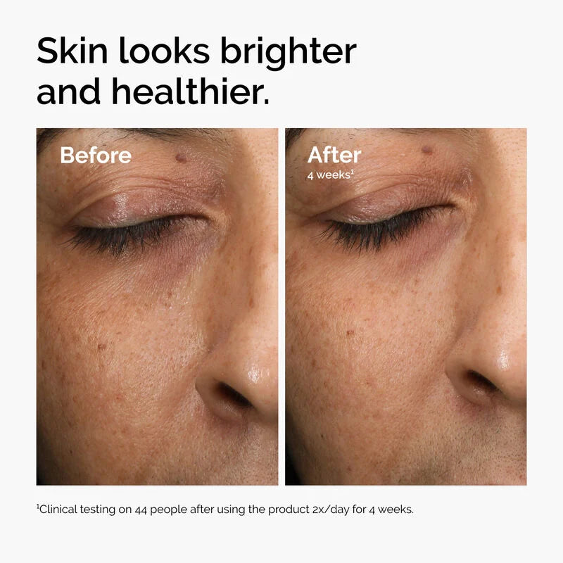 Multi-Antioxidant Radiance Serum